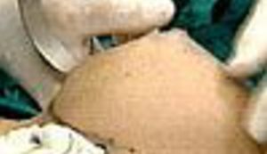 Miss umjetne ljepote