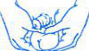 Odsjekao sebi jajca i nosio ih u vrećici