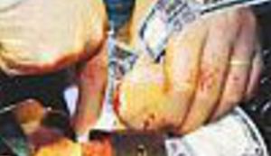 Drago Pilsel: Prodajem bubreg. Hitno!