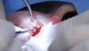 Još jedna "svinjarija" - pojeftino prodaje svoju kožu