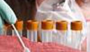 MESO IZ LABORATORIJA: Hoćemo li uskoro jesti meso životinja, a da ih ne ubijemo?