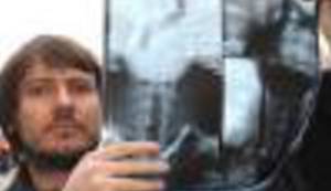 BORBA PROTIV VJETRENJAČA: Kako 'pogrešna dijagnoza' može promijeniti živote