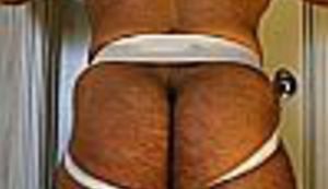 KONFABULATOR: Liječnici otkrili čija je dlaka urasla u stražnjicu ministra Ranka Ostojića